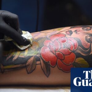 ‘Like being burned with cooking oil’: how tattoo removal became a booming business