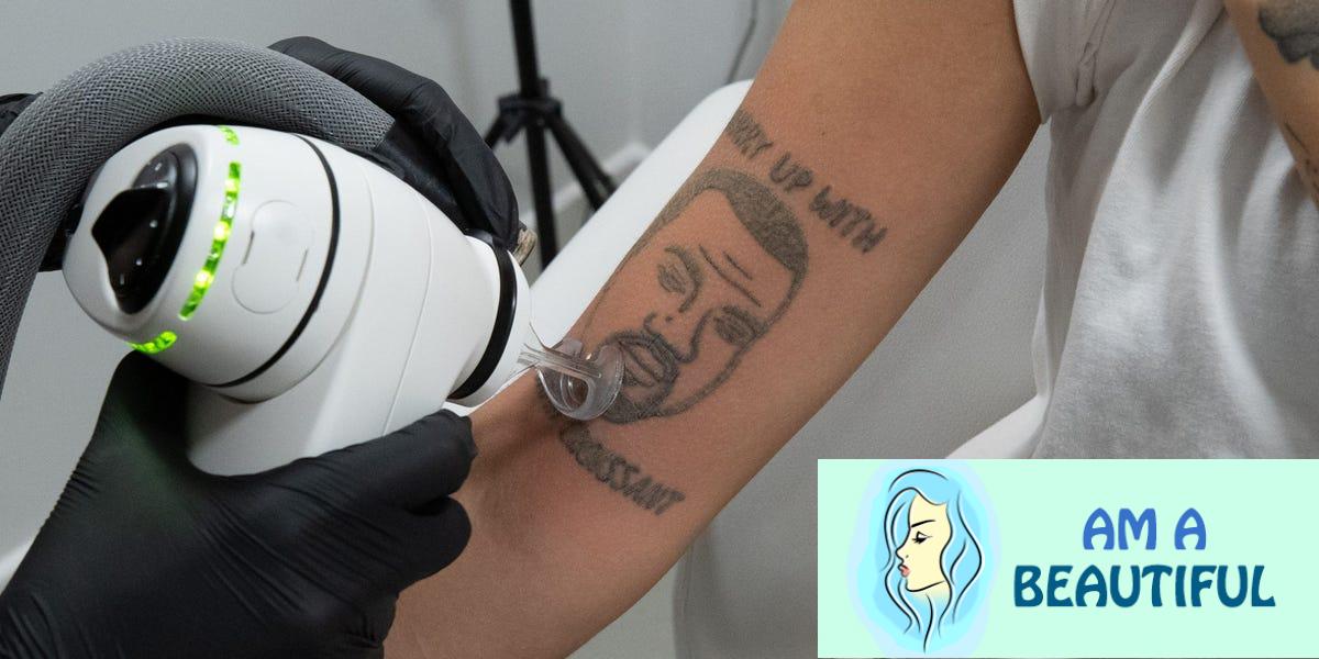 ‘Yeezy come, Yeezy go’: Kanye West tattoos are being removed for free by a studio in London